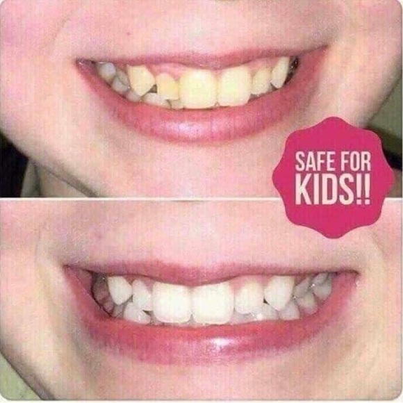 Whitening Toothpaste - Picture 6 of 16